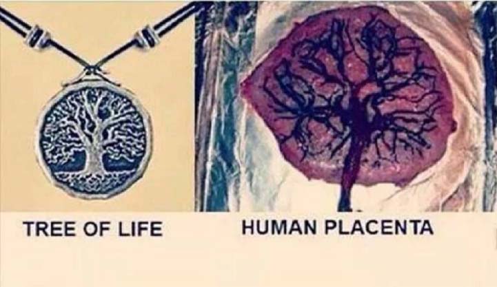 tree and placenta diagram